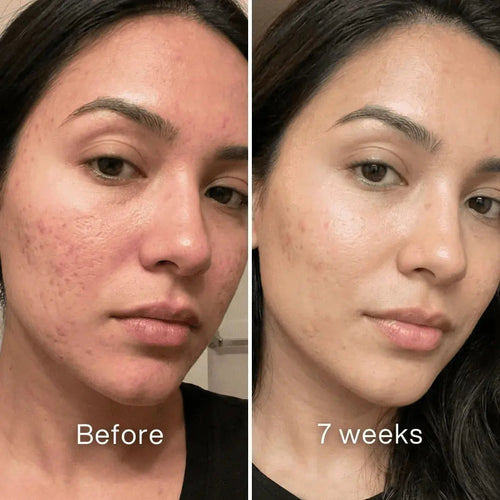 Clinical Scar Recovery System™