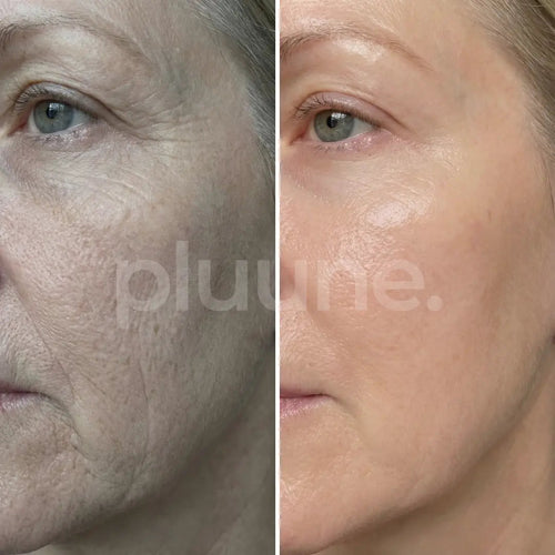 Mature Women’s Skin Recovery Stick™